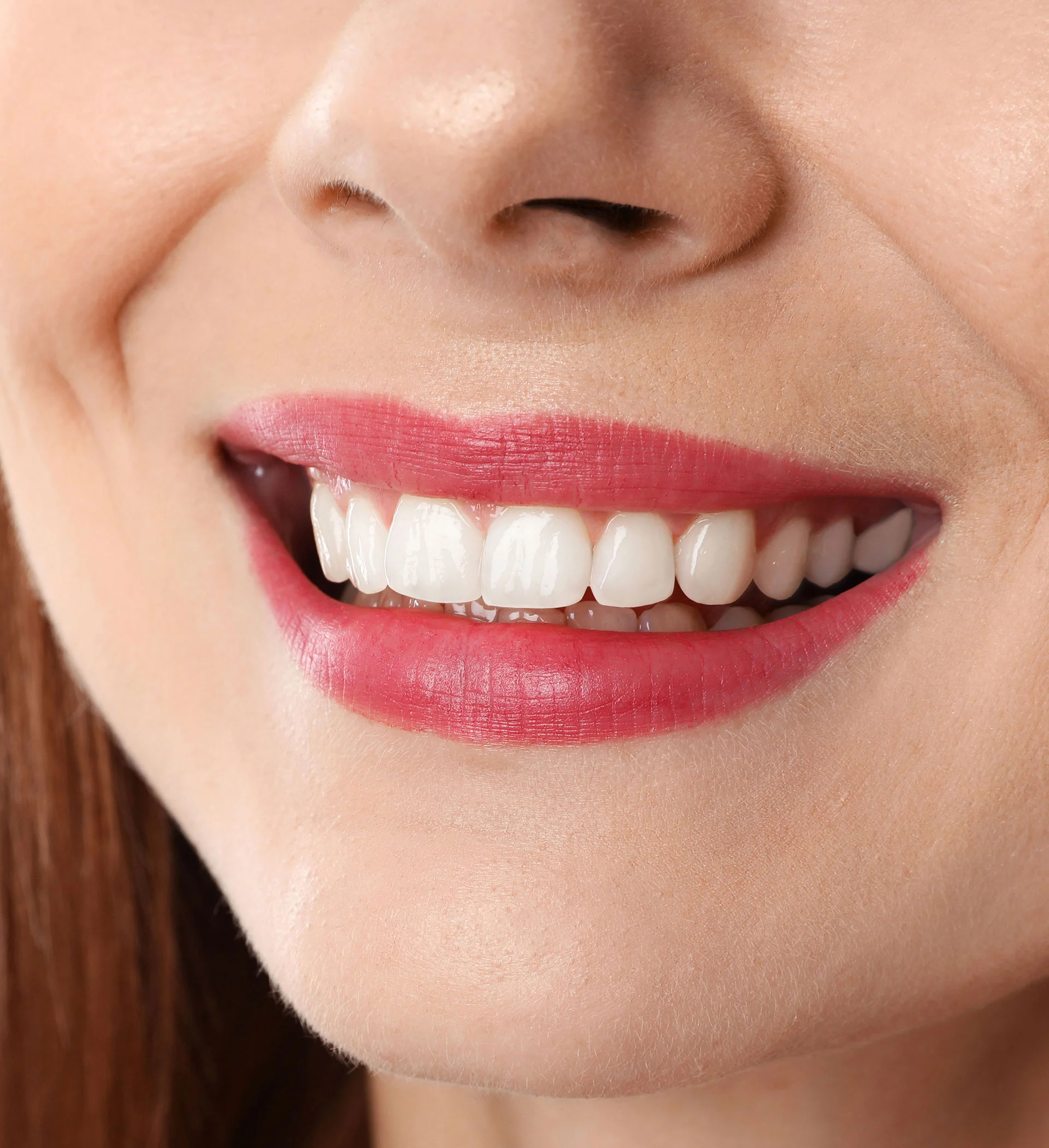 dental-after