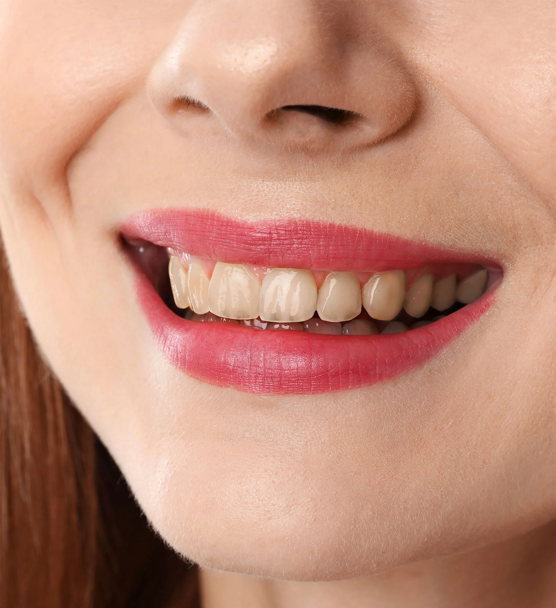 dental-before