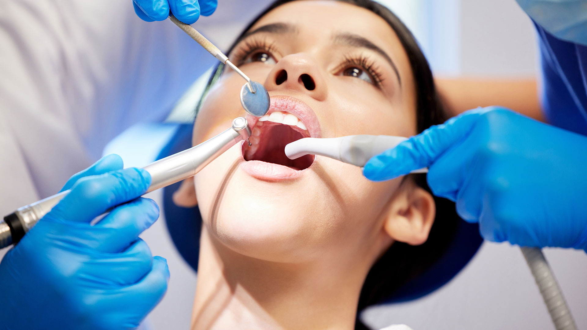 dental-img15