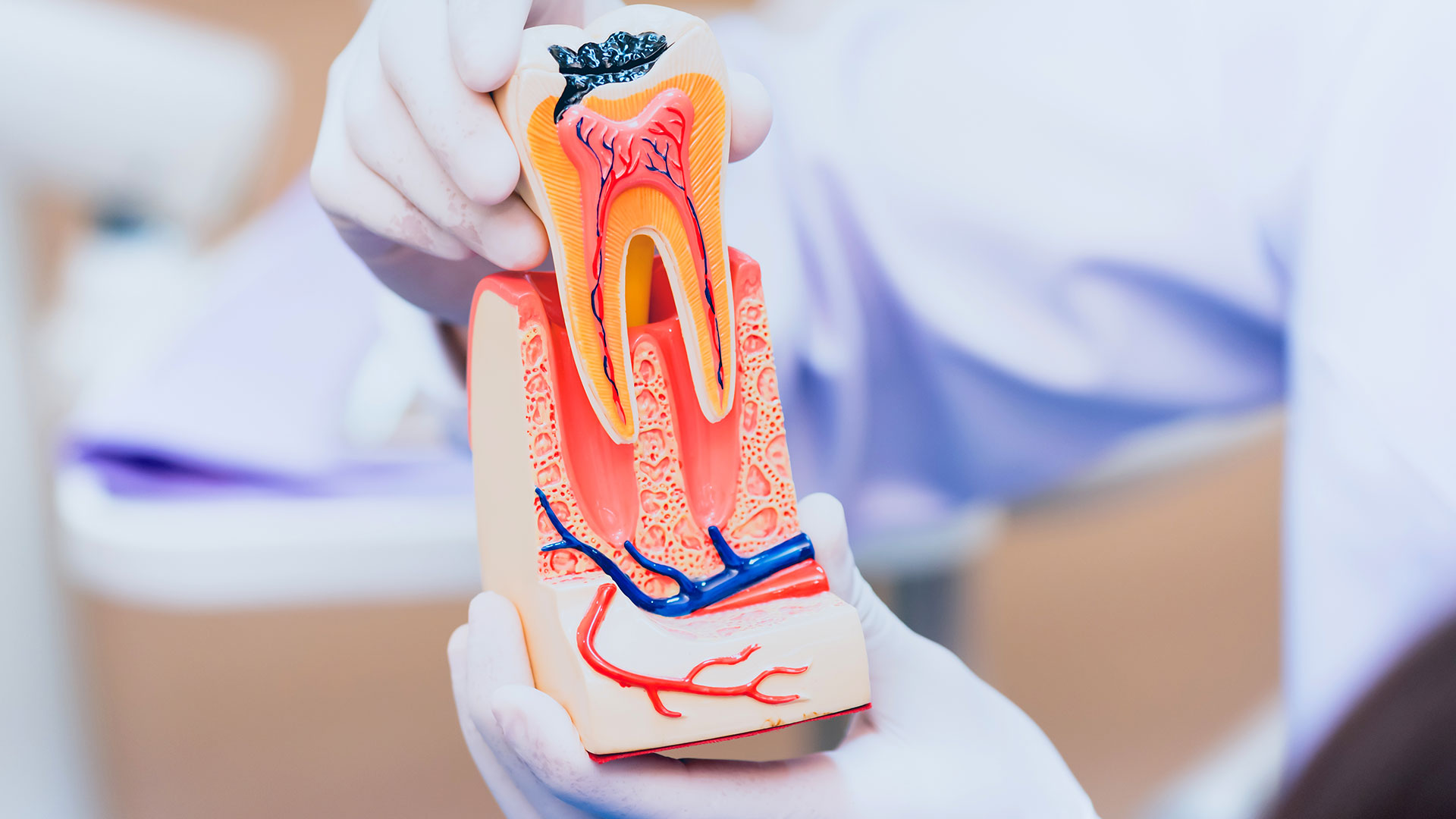 dental-img17