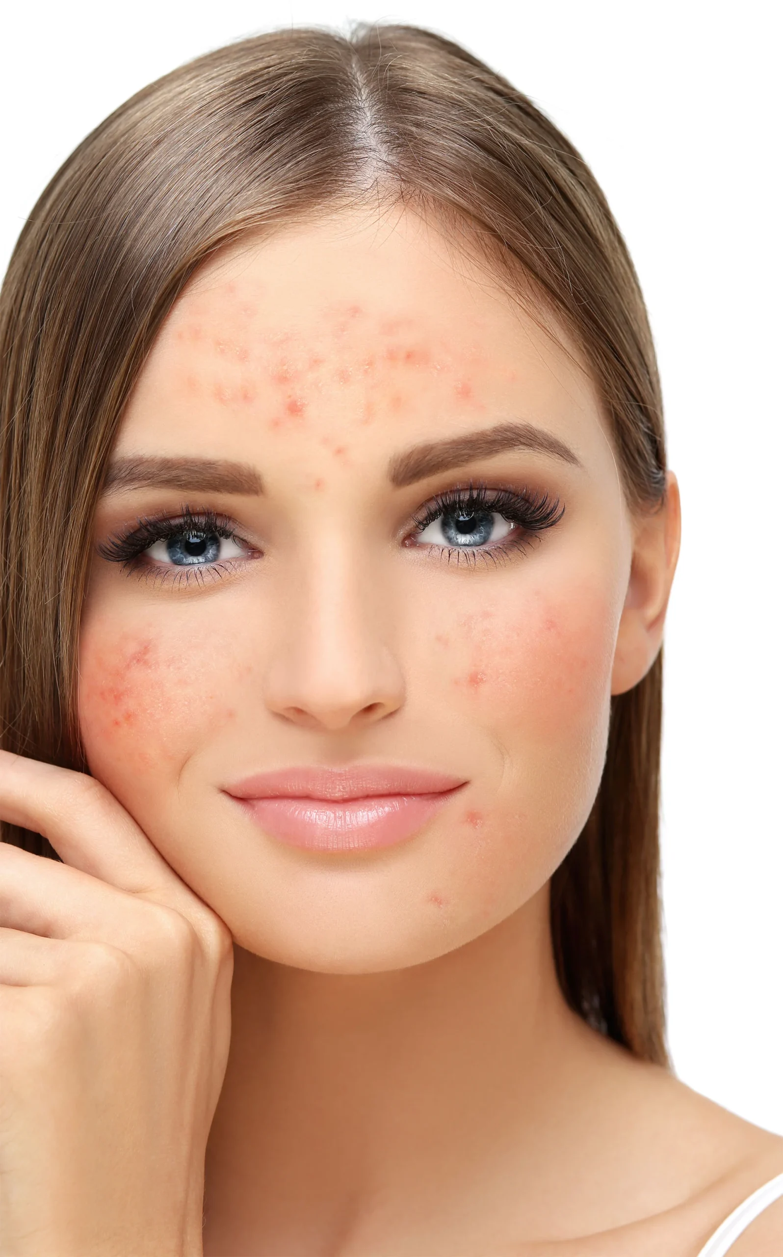 skin-before