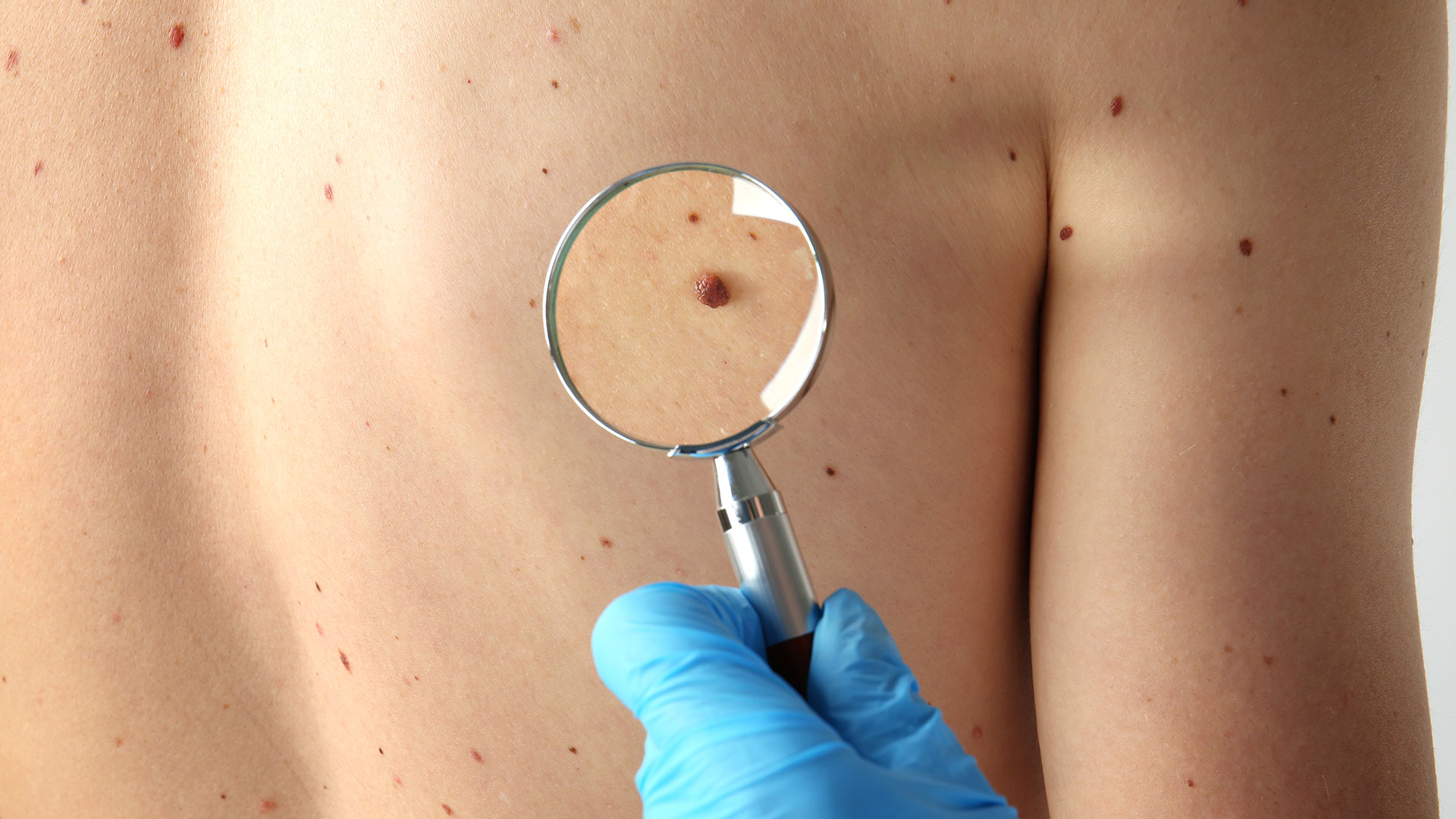 skin11