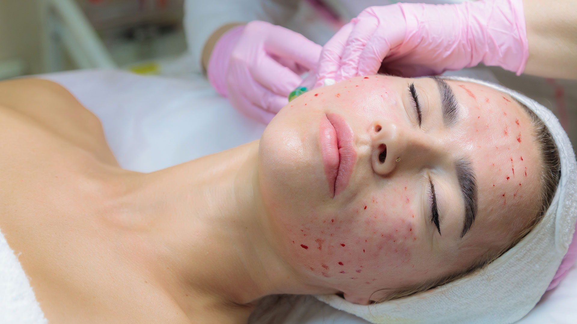 skin4